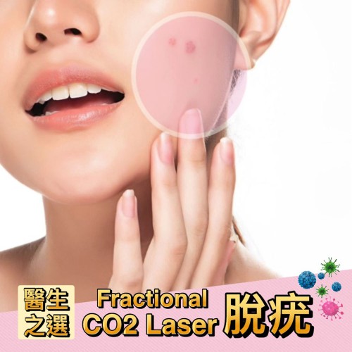 Fractional CO2 Laser．脫疣